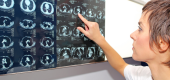 Usach impulsa IA para optimizar tomografías y reducir la exposición de los pacientes a la radiación